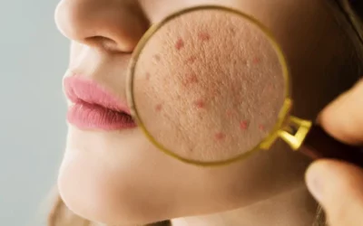 What Does a Dermatologist Do?